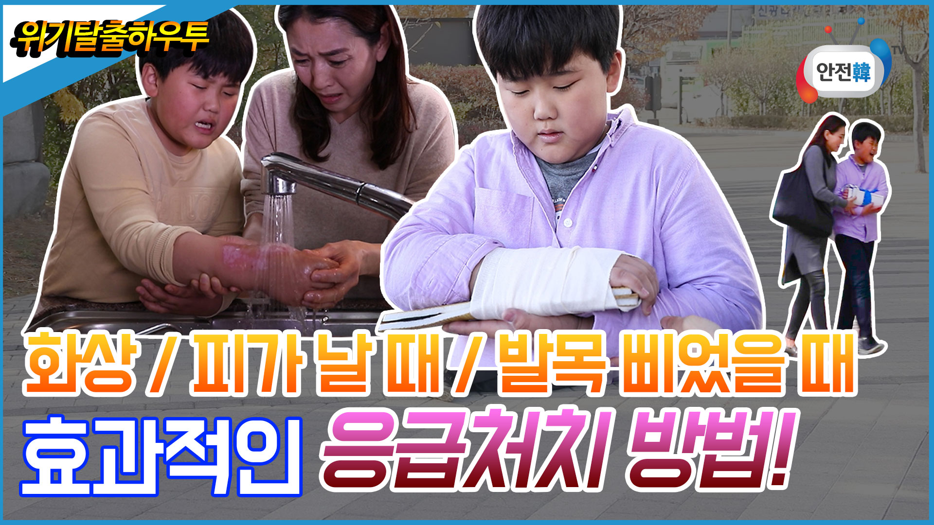 위기탈출하우투 화상/피가 날 때/ 발목 삐었을 때 효과적인 응급처치 방법!